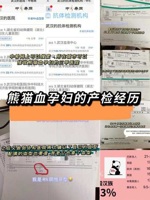 熊猫血是什么血型?稀有血型RH阴性血解析