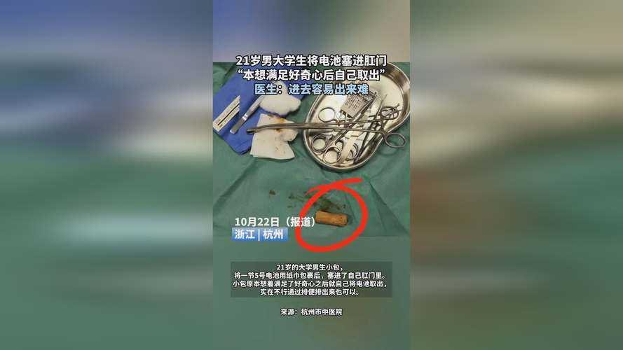 2025《CSGO暴躁阿姨》高清国语正版观看指南
