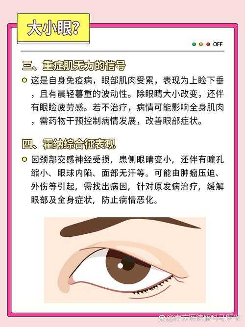 2023年眼部健康新趋势 目突肉陷症状病理机制解析 30岁以