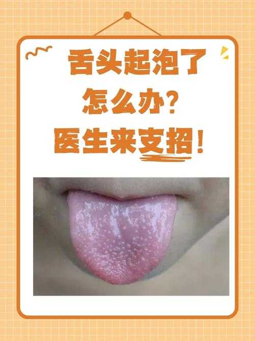 舌头探洞水好多怎么办感觉异常,网友:遇到这种情况真尴尬