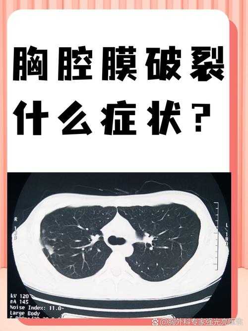 胸膜碎片与2025年遗落的温情
